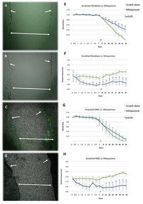 Antibiotics Affect ROS Production and <mark class="highlighted">Fibroblast Migration</mark> in an In-vitro Model of Sinonasal Wound Healing